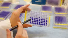 معمل به اختبارات HIV