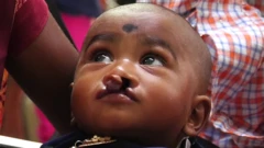 గ్రహణమొర్రి