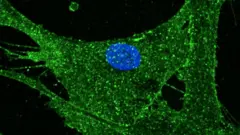 ተመራማሪዎች ይህ የ53 ዓመት ሴት ቆዳ ቢሆንም የሚመስለው እና ተግባሩ የ23 ዓመት ነው ይላሉ።