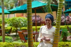 Scleroderma ni ugonjwa wa muda mrefu ambao huathiri ngozi ya mtu , tishu zinazohusika, na viungo vya ndani ya binadamu huathirika .