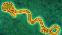 Bimwe mu bimenyetso bya virusi ya Ebola birimo kuribwa umutwe, guhinda umuriro, kuribwa mu muhogo, kubabara mu ngingo, no kuruka