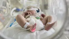 Recém-nascido deitado em maca dormindo