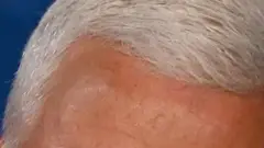 ሙሉ ለሙሉ ስበት ሆነ ጸጉር