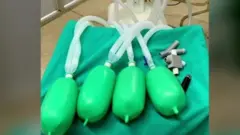 कोरोना व्हायरस, काश्मीर