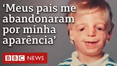 Jono Lancaster foi rejeitado pelos pais e sofreu para se reconciliar com sua própria aparência; agora, ele lança um livro contando sua história.