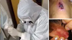 નર્સોની સમસ્યાની તસવીર