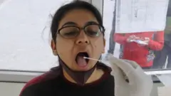 कोरोना