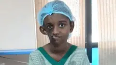 அரியவகை முகச்சிதைவால் பாதிக்கப்பட்ட சிறுமி தான்யா