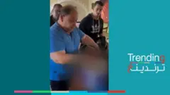 بتر ساق فتاة فلسطينية على طاولة المطبخ