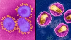 لا يزال يشكل فيروس نقص المناعة البشرية HIV مشكلة للعلماء بعد عشرات الأعوام من ظهوره. فهل سيواجه العلماء نفس المشاكل مع كوفيد-19 في السنوات القادمة؟