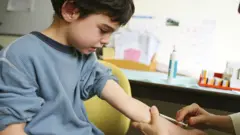 बीसीजी लस