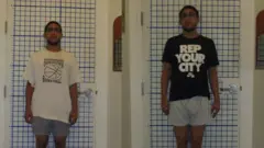 Sam before and after surgery