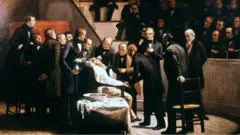 Ilustracija prve demonstracije hirurškog zahvata pod anestezijom u mašačusetskoj Opštoj bolnici 1846. godine