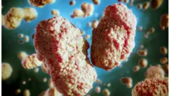 গত পঞ্চাশ বছরের মধ্যে আফ্রিকার বাইরে মাংকিপক্স আর এতটা ছড়ায়নি