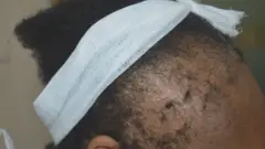 Alopécie : ces coiffures qui nous font perdre nos cheveux !