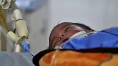 కోవిడ్ సమస్య