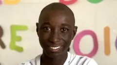 Serigne after treatment