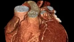 Imagem de rotina de scan cardíaco