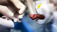 A child cared in the incubator