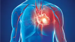 যখন ঔষধে আর কাজ হয়না তখনই প্রয়োজন হয় "ওপেন হার্ট সার্জারি"।