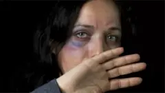 امرأة مكدومة الوجه
