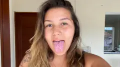 Jovem branca de cabelos compridos mostra a língua, que parece ter pontos de descamação