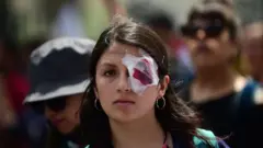 Manifestante chilena con una venda en el ojo