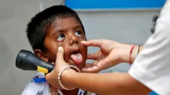 बालकको परीक्षण