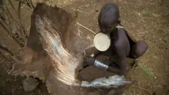 Les enfants de 0 à 5 ans sont les principales victimes de la rougeole. En Ethiopie plusieurs régions ont été touchées
