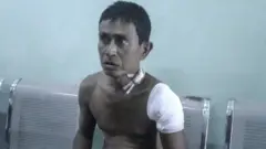 ပုဏ္ဏားကျွန်းမြို့အနီး မိုင်းပေါက်ကွဲ အရပ်သား သေဆုံး ထိခိုက်မှုရှိ