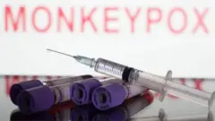 குரங்கம்மை