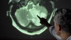 Konsultan neurologis Arvind Chandratheva menunjuk bagian otak yang rusak akibat virus corona.