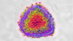 Igishushanyo kigaragaraza coronavirus