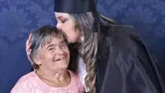 Filha beija mãe com síndrome de Down