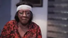 Mide Martins we bandeji to ni ẹjẹ mọ ori