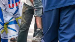 On voit la jambe blessée d'un homme lors d'une manifestation où des manifestants et des policiers se sont affrontés à Kinshasa le 9 juillet 2020
