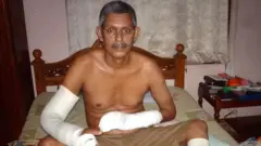 रुग्णालयात 35 दिवस उपचार घेतल्यानंतरच प्रा. टी. जे जोसेफ घरी परतू शकले.