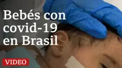 Bebé enfermo de covid en Brasil