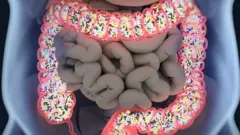 صورة توضيحية للأمعاء