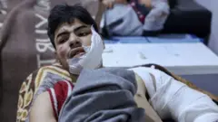 Heridos en Turquía.