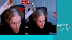 أحدب وشاحب الوجه مع تجويف في الجمجمة وظهر مقوس... هذه الأعراض يمكن أن تظهر على مدمني الألعاب الإلكترونية، بحسب بعض الدراسات.