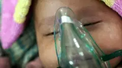 Pneumonia