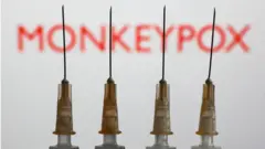 vacina contra monkeypox