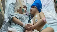 샴쌍둥이