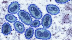 monkeypox virus