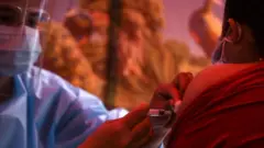 खोप