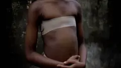 ब्रेस्ट आयर्निंग