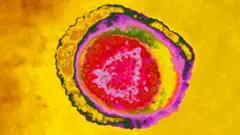 હર્પિસ વાઇરસ