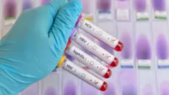Exames de sangue para diagnóstico de ISTs