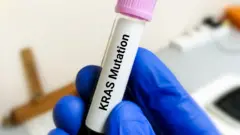 Mutación KRAS